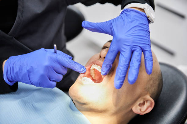 Best Emergency Wisdom Tooth Extraction in Waynesboro, TN